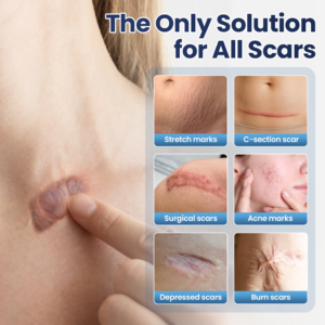 Nexisify® DERMALUX Texture Repair Gel