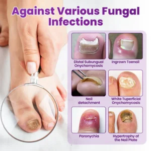 Cvreoz® AeroFilm Foot Defense Mist image Cvreoz® AeroFilm Foot Defense Mist