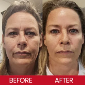 LIMETOW® Retinol Eye Stick