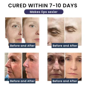 LIMETOW® Anti-Wrinkle Moisturizing Cream