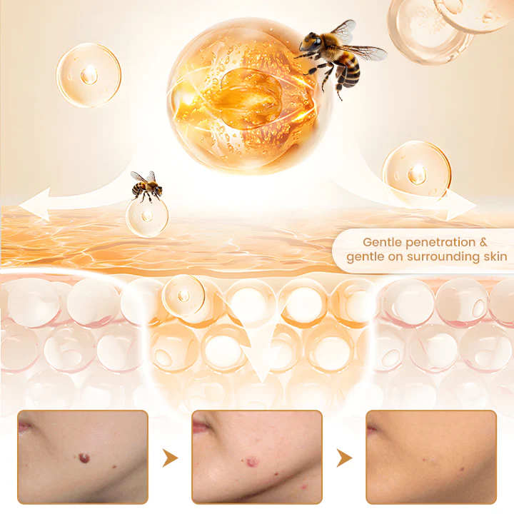 Biancat® BeeVenom Wart Drop Serum