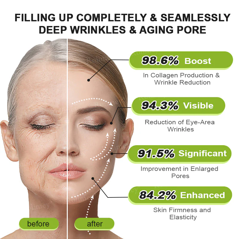 Rolimey® Botox & Vita-A Retinol Shot Wrinkle-Lift Tightening cream image Rolimey® Botox & Vita-A Retinol Shot Wrinkle-Lift Tightening cream - Image 16