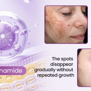 Biancat® RadiantClear Blemish & Brightening Serum