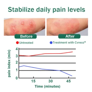 Cvreoz®Snake Peptide Shingles Skincare Ampoules