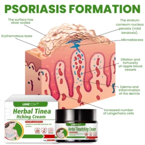 LIMETOW® Herbal Tinea Itching Cream