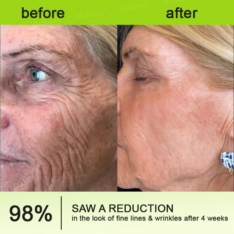 Rolimey® Botox & Vita-A Retinol Shot Wrinkle-Lift Tightening cream image Rolimey® Botox & Vita-A Retinol Shot Wrinkle-Lift Tightening cream - Image 12