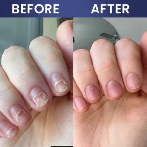LIMETOW® Nail Repair Solution