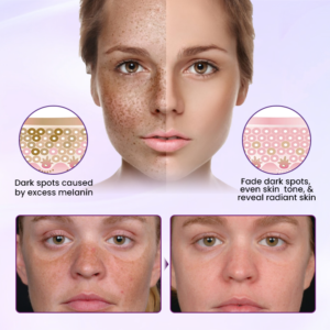 Biancat® RadiantClear Blemish & Brightening Serum