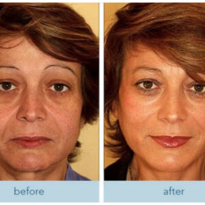 Olavita Liquid Solution image Olavita Liquid Solution