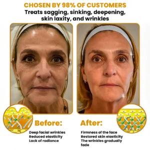 Luxevéria Bee Venom Anti-Wrinkle Crean