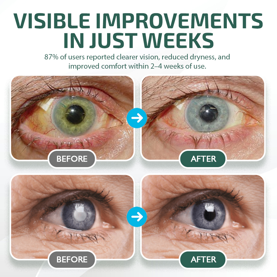 NEGUSY™ Nano Eye Drops Serum