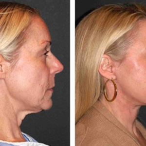 Olavita Liquid Solution image Olavita Liquid Solution