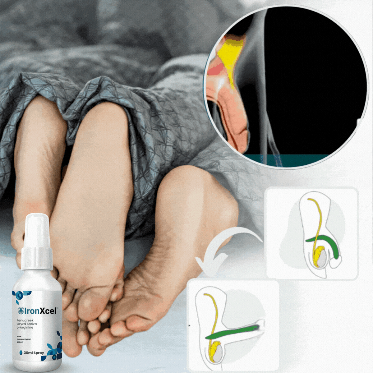 IronXcel™ Algae Erection Spray