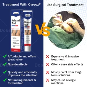 Cvreoz® Mole and Wart Removal Cream image Cvreoz® Mole and Wart Removal Cream
