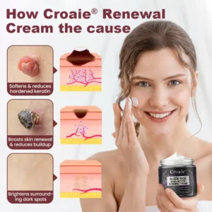 Croaie® BLACK RICE DUAL-ACTION RENEWAL CREAM
