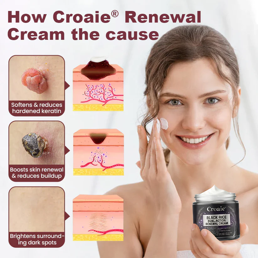 Croaie® BLACK RICE DUAL-ACTION RENEWAL CREAM