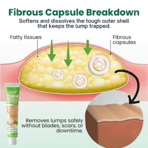 Cvreoz® Knot-X Lipoma Dissolve Cream image Cvreoz® Knot-X Lipoma Dissolve Cream