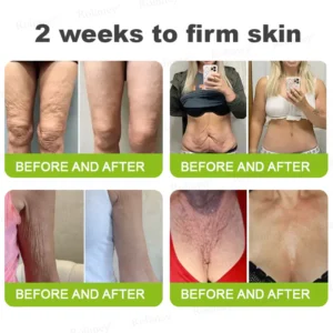 Rolimey® Botox & Vita-A Retinol Shot Wrinkle-Lift Tightening cream image Rolimey® Botox & Vita-A Retinol Shot Wrinkle-Lift Tightening cream