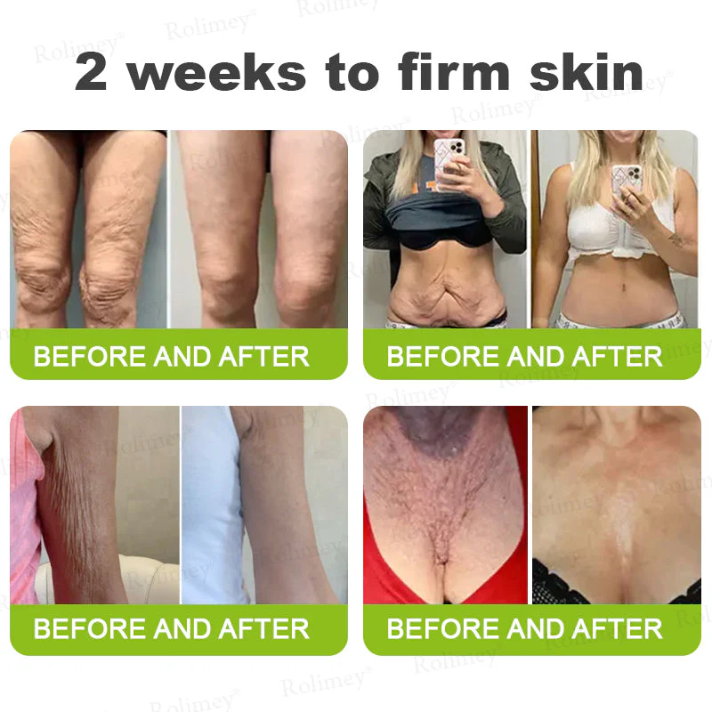 Rolimey® Botox & Vita-A Retinol Shot Wrinkle-Lift Tightening cream image Rolimey® Botox & Vita-A Retinol Shot Wrinkle-Lift Tightening cream - Image 8