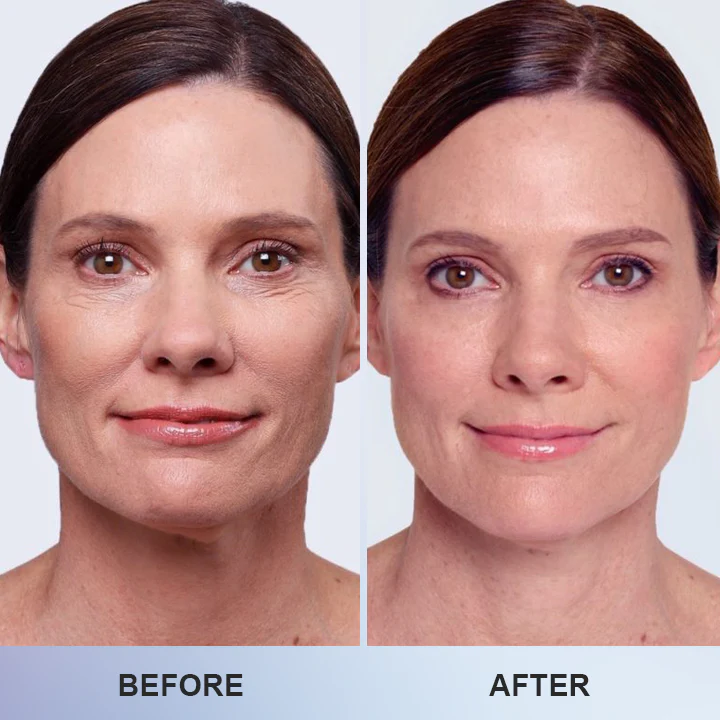 LIMETOW™ Line Smoothing Eye Cream image LIMETOW™ Line Smoothing Eye Cream