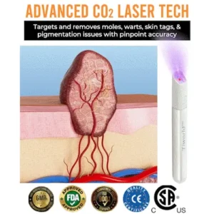 TIWORLD™ All-in-One CO₂ Laser Eraser Pen image TIWORLD™ All-in-One CO₂ Laser Eraser Pen