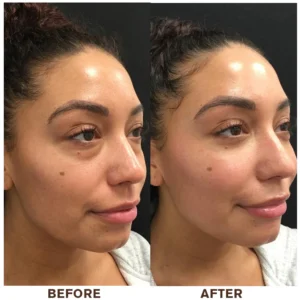 LIMETOW®Instant Eye Cream Tightener