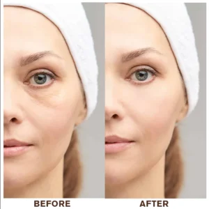 LIMETOW®Instant Eye Cream Tightener