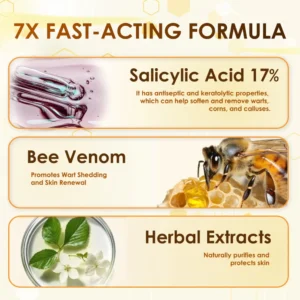 ZOVAMUSE Bee Venom Wart Corn & Callus Remover Cream