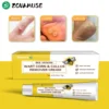 ZOVAMUSE Bee Venom Wart Corn & Callus Remover Cream image ZOVAMUSE Bee Venom Wart Corn & Callus Remover Cream