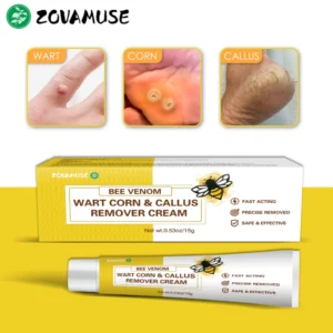 ZOVAMUSE Bee Venom Wart Corn & Callus Remover Cream