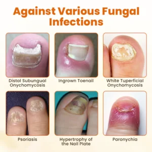 Alisanda® FungiBee Advanced Nail Repair Spray image Alisanda® FungiBee Advanced Nail Repair Spray