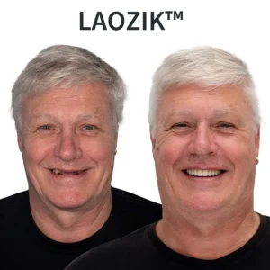 LAOZIK™ Custom-Fit Functional Dentures image LAOZIK™ Custom-Fit Functional Dentures