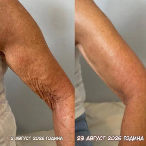 LEFUN® Skin Rejuvenation and Tightening Oil