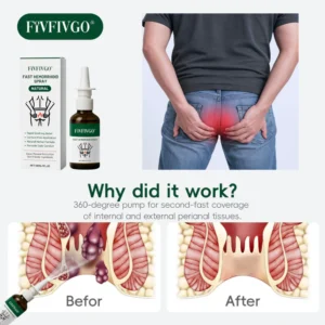 Fivfivgo® Fast Hemorrhoid Spray
