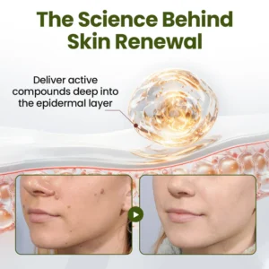 Fivfivgo® MagneErase Renewal Cream image Fivfivgo® MagneErase Renewal Cream