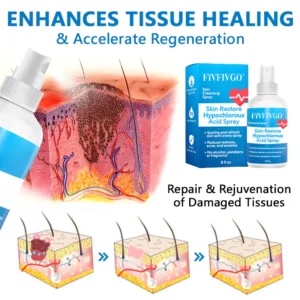 Fivfivgo® Skin Restore Hypochlorous Acid Spray image Fivfivgo® Skin Restore Hypochlorous Acid Spray