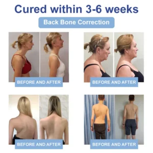 LOVILDS™ Black Rice Pain Healing Bone Cream