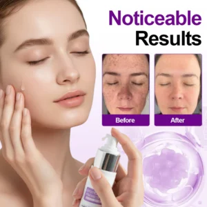 Zvoevo® SpotErase Probiotic Shield Serum image Zvoevo® SpotErase Probiotic Shield Serum