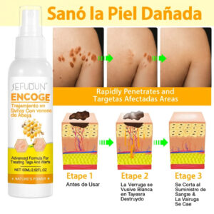 Sefudun Tag Recede Wart Remover Spray