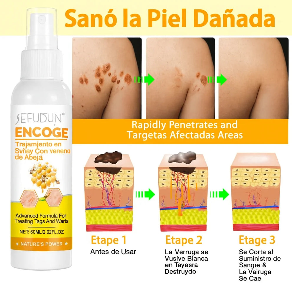 Sefudun Tag Recede Wart Remover Spray