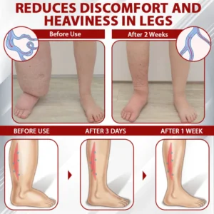 NovaRX® Red Vine FluidRelief Edema Gel image NovaRX® Red Vine FluidRelief Edema Gel