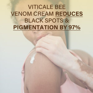 Oveallgo® VitiClear Bee Venom Cream image Oveallgo® VitiClear Bee Venom Cream