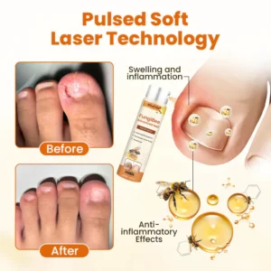 Alisanda® FungiBee Advanced Nail Repair Spray image Alisanda® FungiBee Advanced Nail Repair Spray