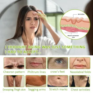 Rolimey® Botox & Vita-A Retinol Shot Wrinkle-Lift Tightening cream image Rolimey® Botox & Vita-A Retinol Shot Wrinkle