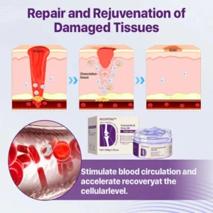 Misspone™ Curcumin & Emu Oil Pain Gel