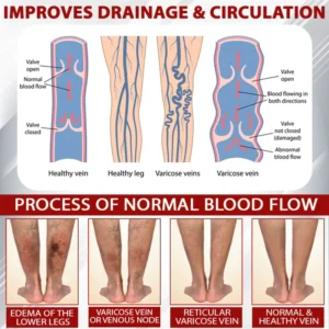 NovaRX® Red Vine FluidRelief Edema Gel image NovaRX® Red Vine FluidRelief Edema Gel
