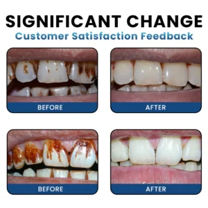 LIMETOW® Teeth Whitening Essence