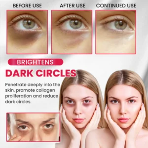 LIMETOW® Retinol Eye Stick