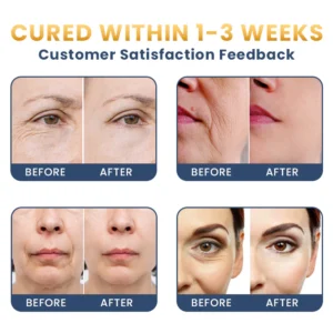 LIMETOW® Anti-Wrinkle Moisturizing Cream