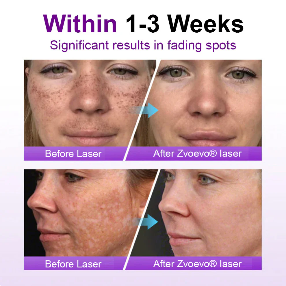 Zvoevo® SpotErase Probiotic Shield Serum image Zvoevo® SpotErase Probiotic Shield Serum